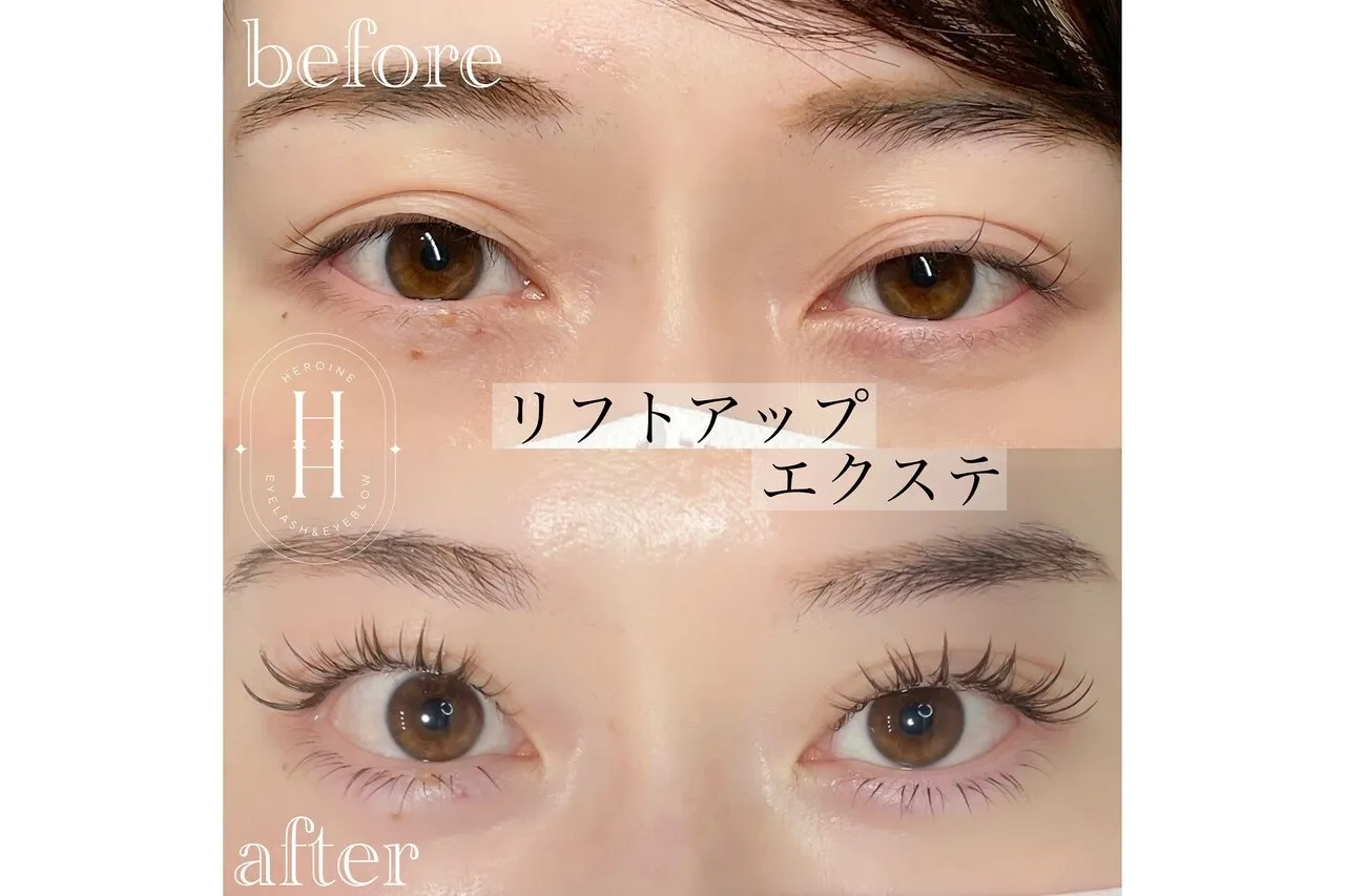 リフトアップエステ